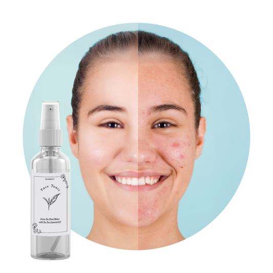 Anti-Acne Purifying Face Tonic